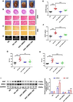 Epigenetic Reader Bromodomain Containing Protein 2 Facilitates Pathological Cardiac Hypertrophy via Regulating the Expression of Citrate Cycle Genes